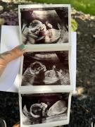 Personal picture